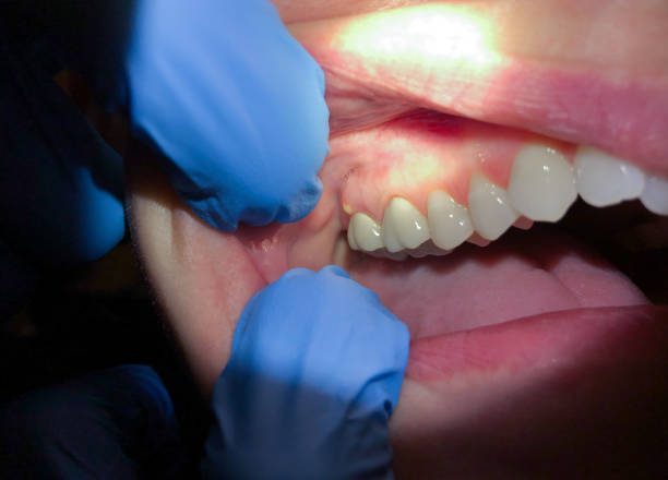 Best After-Hours Dental Trauma Care in Goshen, KY
