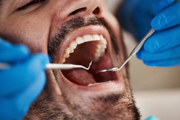 Best Emergency Treatment for Dental Infections or Abscesses in Goshen, KY
